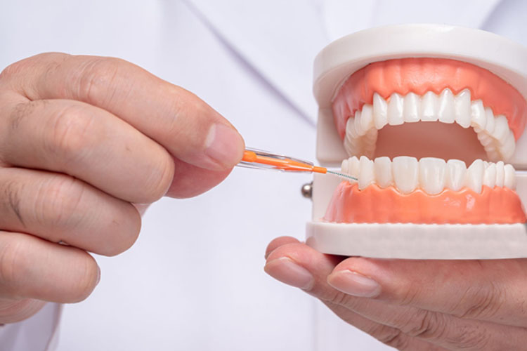 تمامی فواصل بین دندانها را تمیز کنید و به قسمتهایی که کمتر در دسترس هستند، توجه ویژهای داشته باشید.